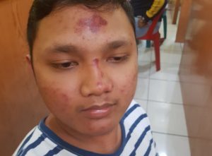 Pengeroyokan di Tempat Hiburan Malam, Pelaku Harus Segera Ditangkap 