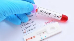 Kasus Terus Melandai, Menkes Sebut Warga RI Punya ‘Super Immunity’ Covid-19