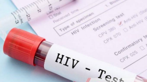 Banyak Ibu Rumah Tertular HIV, Kemenkes: 33 Persen dari Suami