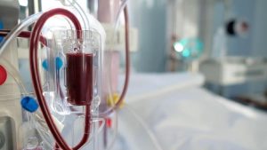 PBI Diputus, Pasien Tidak Bisa Cuci Darah, Ini Kata BPJS Kesehatan